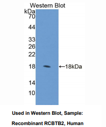 https://msimg.bioon.com/bionline/goods-no-pic.png