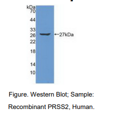 人丝氨酸蛋白酶2(PRSS2)多克隆抗体