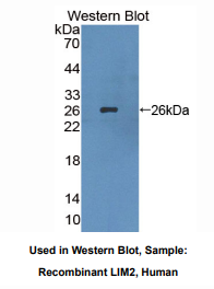 https://msimg.bioon.com/bionline/goods-no-pic.png