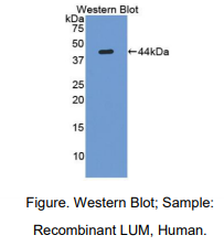 https://msimg.bioon.com/bionline/goods-no-pic.png