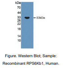 https://msimg.bioon.com/bionline/goods-no-pic.png