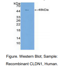 https://msimg.bioon.com/bionline/goods-no-pic.png