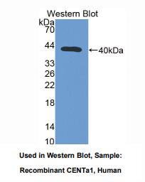 人矢车菊苷α1(CENTa1)多克隆抗体