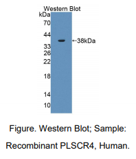 https://msimg.bioon.com/bionline/goods-no-pic.png