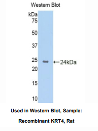 https://msimg.bioon.com/bionline/goods-no-pic.png