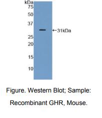 小鼠生长激素受体(GHR)多克隆抗体