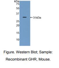 https://msimg.bioon.com/bionline/goods-no-pic.png