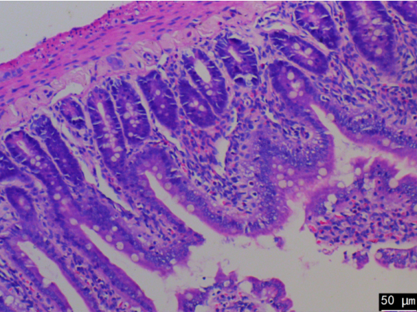 https://img.medsci.cn/ca41ba0460152ae456a8b82f7e52ad91a0a12fdeaf2e0241256f6a7ac183b2c9.jpg