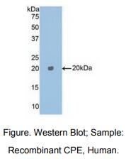 https://msimg.bioon.com/bionline/goods-no-pic.png