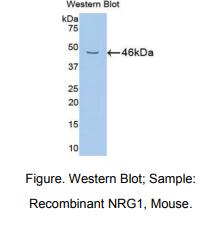 https://msimg.bioon.com/bionline/goods-no-pic.png