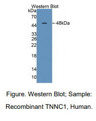 人慢肌肌钙蛋白C(TNNC1)多克隆抗体