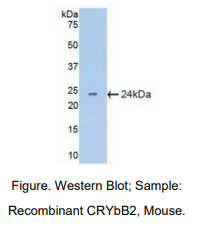 https://msimg.bioon.com/bionline/goods-no-pic.png