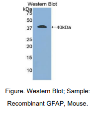 https://msimg.bioon.com/bionline/goods-no-pic.png