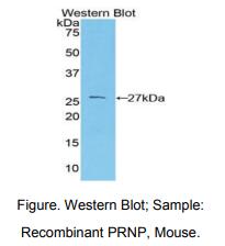 https://msimg.bioon.com/bionline/goods-no-pic.png