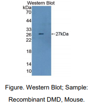 https://msimg.bioon.com/bionline/goods-no-pic.png