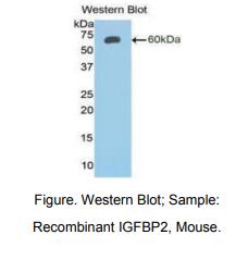 https://msimg.bioon.com/bionline/goods-no-pic.png