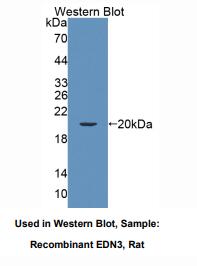 https://msimg.bioon.com/bionline/goods-no-pic.png