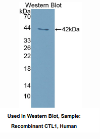 https://msimg.bioon.com/bionline/goods-no-pic.png