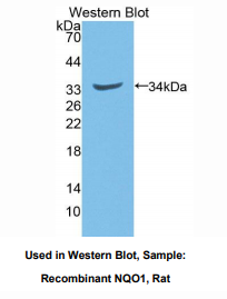 https://msimg.bioon.com/bionline/goods-no-pic.png