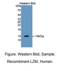 人溶菌酶(LZM)多克隆抗体
