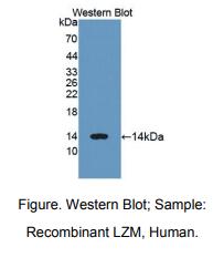 https://msimg.bioon.com/bionline/goods-no-pic.png