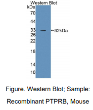 https://msimg.bioon.com/bionline/goods-no-pic.png