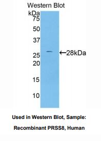 https://msimg.bioon.com/bionline/goods-no-pic.png