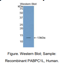 人胞浆多聚A结合蛋白1样蛋白(PABPC1L)多克隆抗体