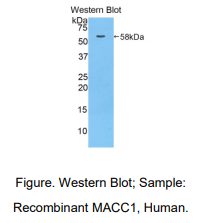 人结肠癌转移关联基因1(MACC1)多克隆抗体