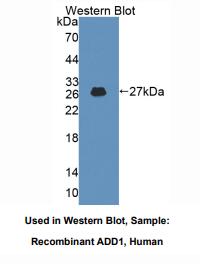 https://msimg.bioon.com/bionline/goods-no-pic.png