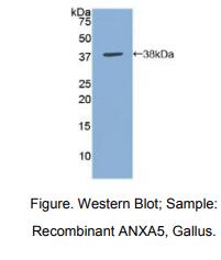 https://msimg.bioon.com/bionline/goods-no-pic.png