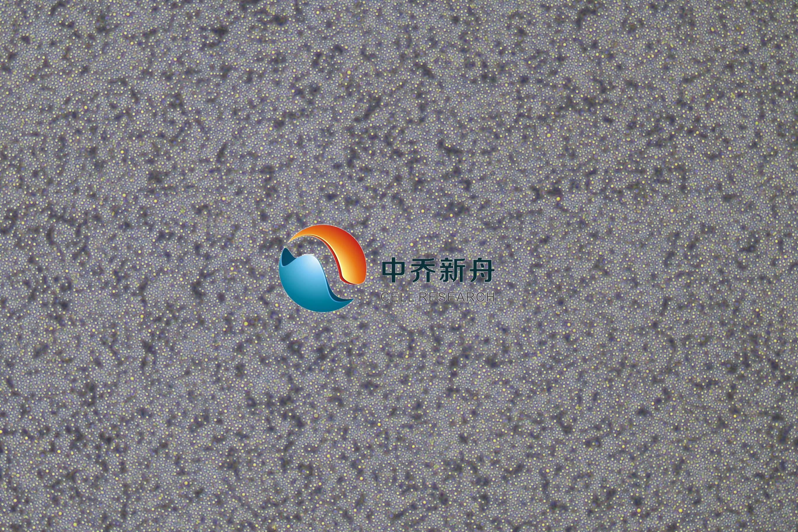 弥漫大B细胞淋巴瘤