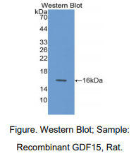 https://msimg.bioon.com/bionline/goods-no-pic.png