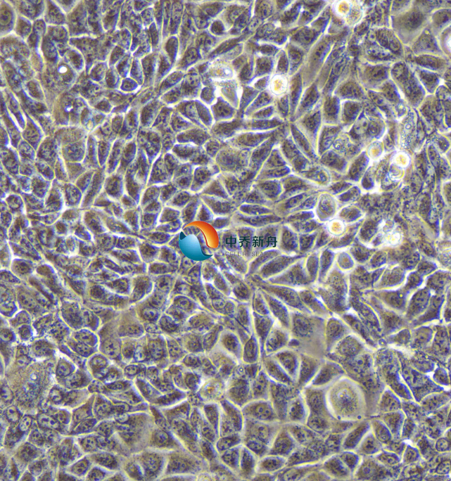 https://img.medsci.cn/8eee53bbc4cb7a98de615e72115896bc4e27fda5cbb764dbd67d9d641c2bb46a.png