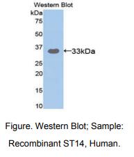 https://msimg.bioon.com/bionline/goods-no-pic.png