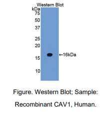 https://msimg.bioon.com/bionline/goods-no-pic.png