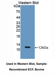 https://msimg.bioon.com/bionline/goods-no-pic.png