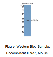 https://msimg.bioon.com/bionline/goods-no-pic.png