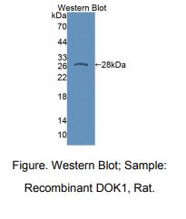 https://msimg.bioon.com/bionline/goods-no-pic.png