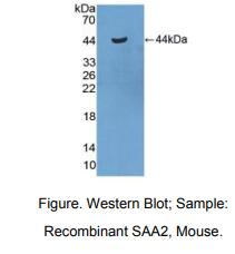 小鼠血清淀粉样蛋白A2(SAA2)多克隆抗体