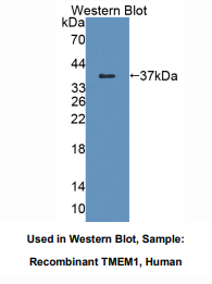 人跨膜蛋白1(TMEM1)多克隆抗体