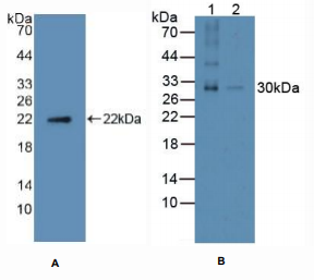 人核因子κB受体激活因子配体(RANkL)多克隆抗体