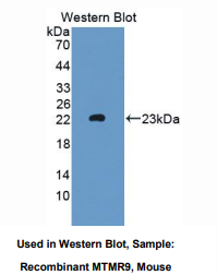 https://msimg.bioon.com/bionline/goods-no-pic.png