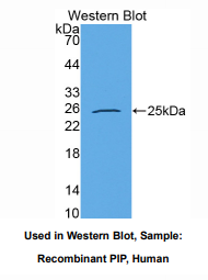 https://msimg.bioon.com/bionline/goods-no-pic.png