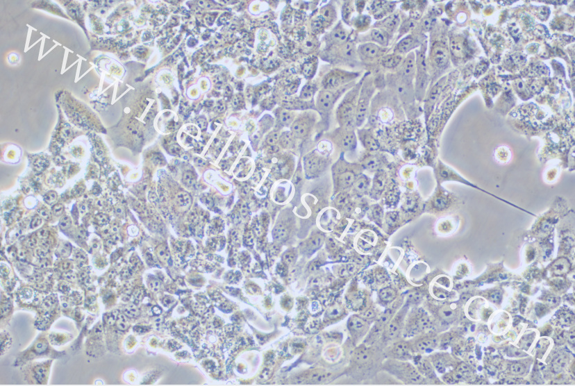 OE-33细胞/OE33细胞/OE-33/OE33/人食管腺癌细胞