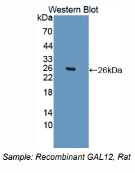 大鼠半乳糖凝集素12(GAL12)多克隆抗体