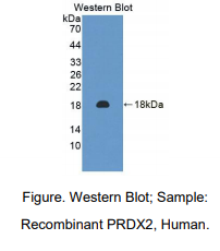 人过氧化还原酶2(PRDX2)多克隆抗体