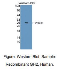 人生长激素2(GH2)多克隆抗体