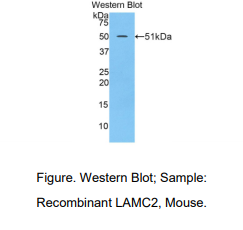 小鼠层粘连蛋白γ2(LAMC2)多克隆抗体