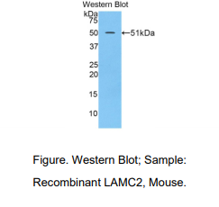 https://msimg.bioon.com/bionline/goods-no-pic.png